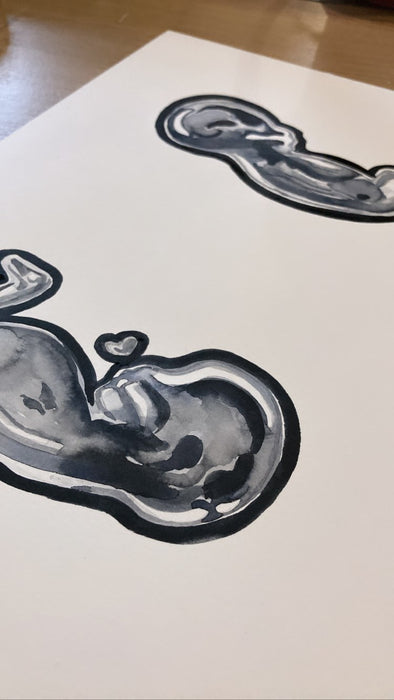 Ultrasound Scan Art >12 Weeks