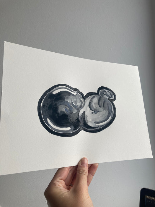 Ultrasound Scan Art >12 Weeks