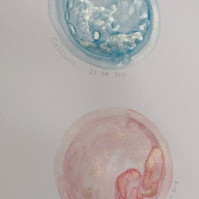 Embryo and Baby Scan Art