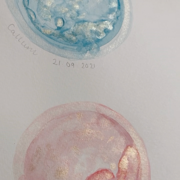 Embryo and Baby Scan Art