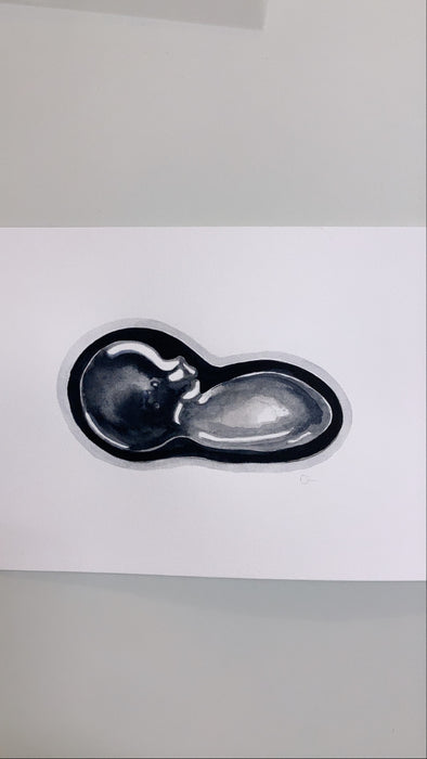 Ultrasound Scan Art >12 Weeks