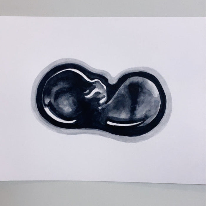 Ultrasound Scan Art >12 Weeks