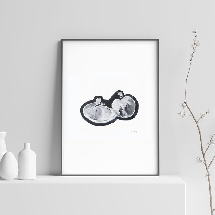 Ultrasound Scan Art >12 Weeks