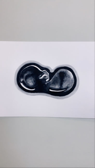 Ultrasound Scan & Sonogram Art >12 Weeks
