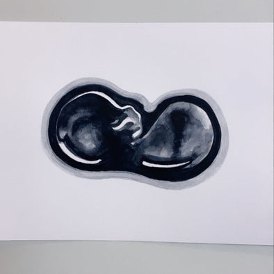 Ultrasound Scan & Sonogram Art >12 Weeks