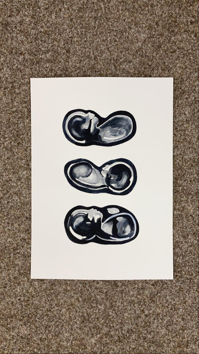 Ultrasound Scan & Sonogram Art >12 Weeks